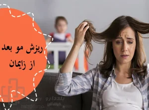 ریزش مو بعد از زایمان