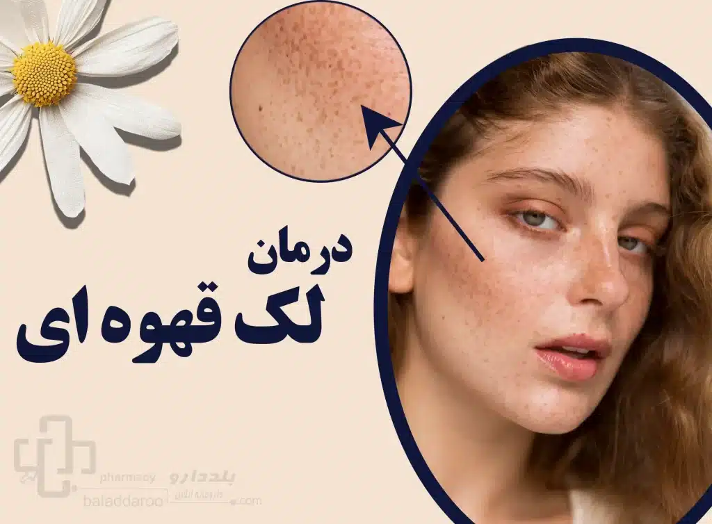 درمان لک قهوه ای پوست